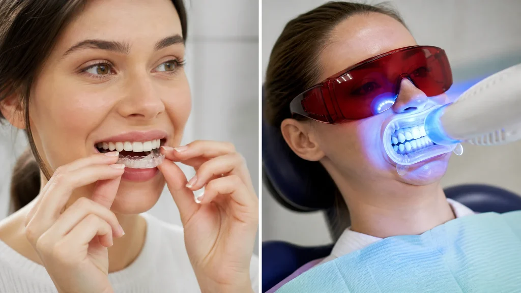 Blanchiment dentaire à domicile ou chez le dentiste : comparaison des méthodes, des coûts et des risques