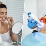 Zahnbleaching zu Hause oder beim Zahnarzt: Methoden, Kosten und Risiken im Vergleich