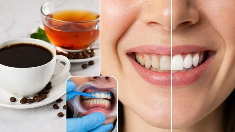 Zahnverfärbungen durch Kaffee und Tee: Ursachen, Hilfe und Bleaching