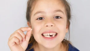 Zahnwechsel bei Kindern: Wann fallen welche Milchzähne aus?